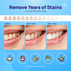 Gentle whitening formula suitable for sensitive teeth