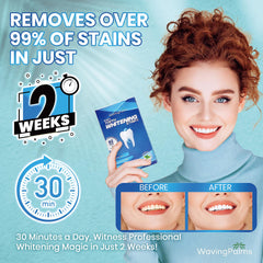 Non-slip whitening strips staying in place during use