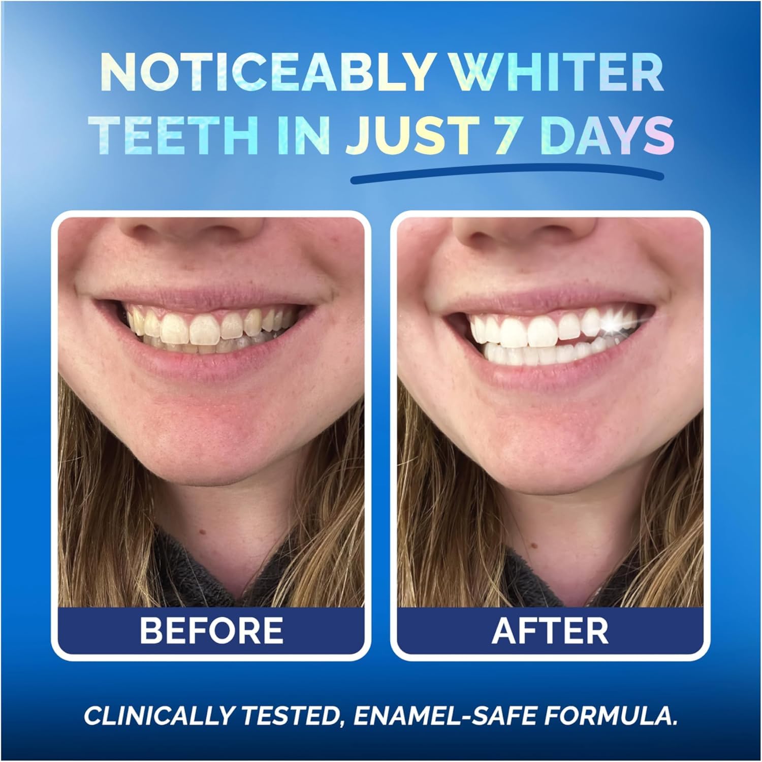 Coffee, tea, wine stain removal with gentle whitening
