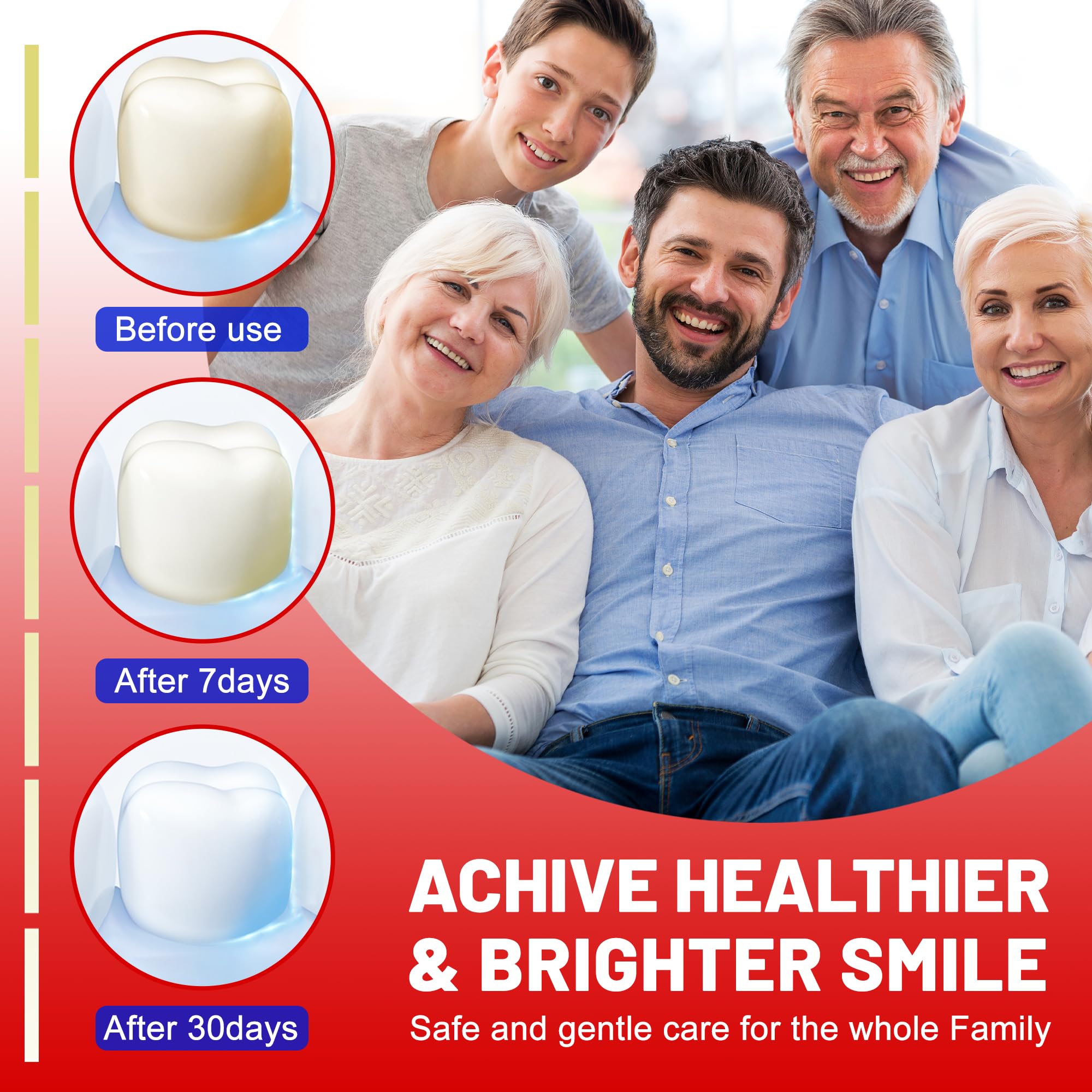 Whitening result showing a brighter smile