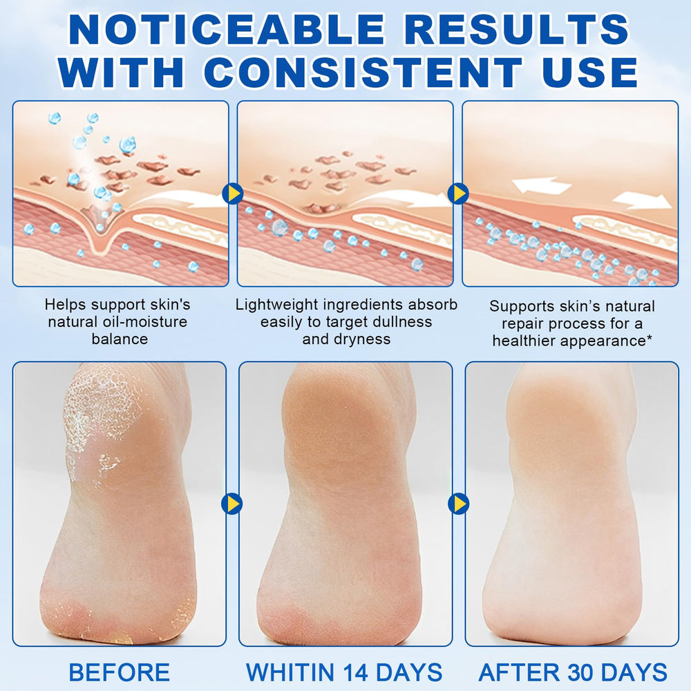 XIAMOFUZHOU stick targets calluses on soles for smoother texture.