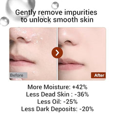 XOTMPFLY peel shot packaging highlights cleansing and hydration.