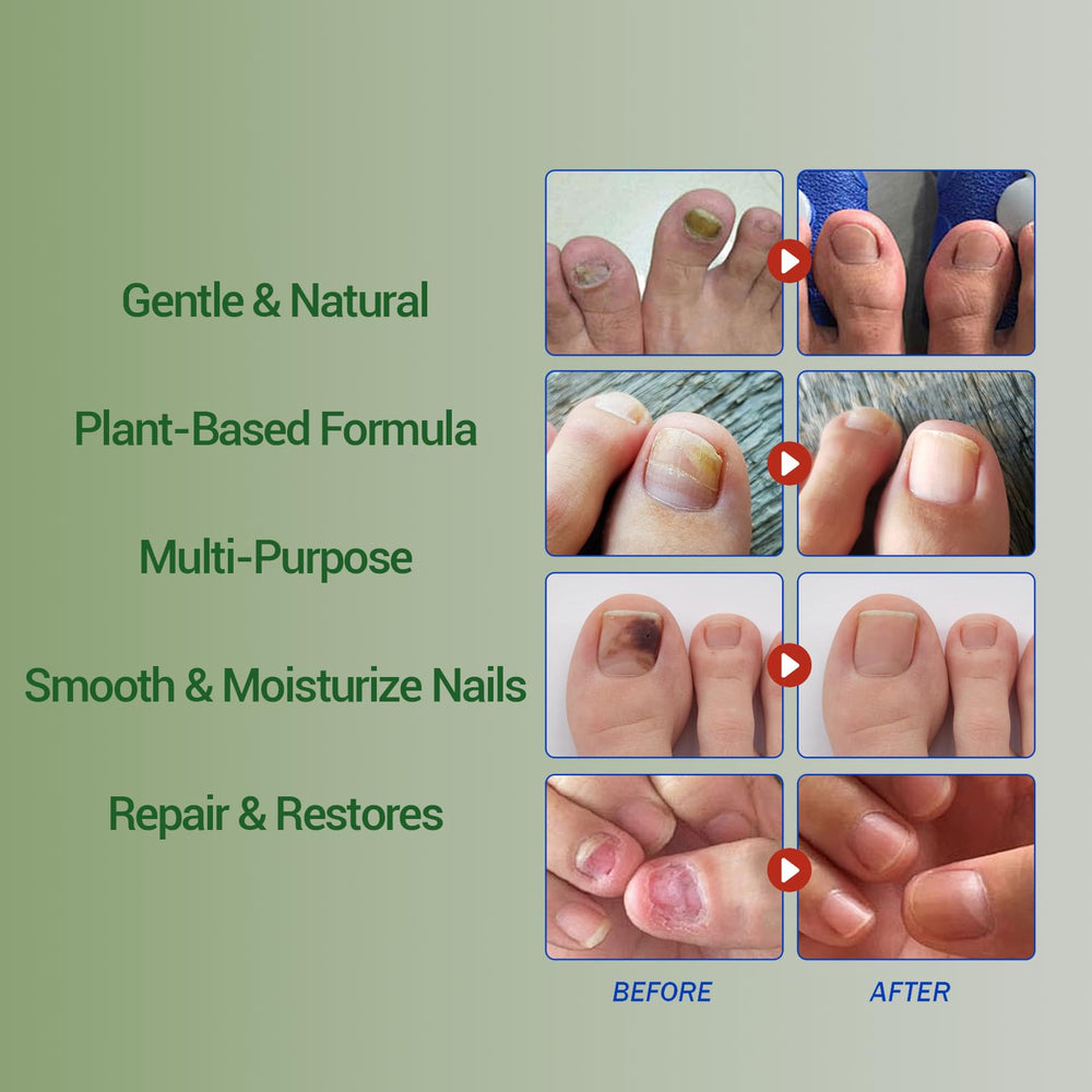 Xvywalo nails before and after use showing healthier appearance