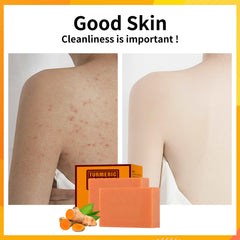 YAFUSIPE turmeric soap with natural oils nourishing the skin during cleanse.