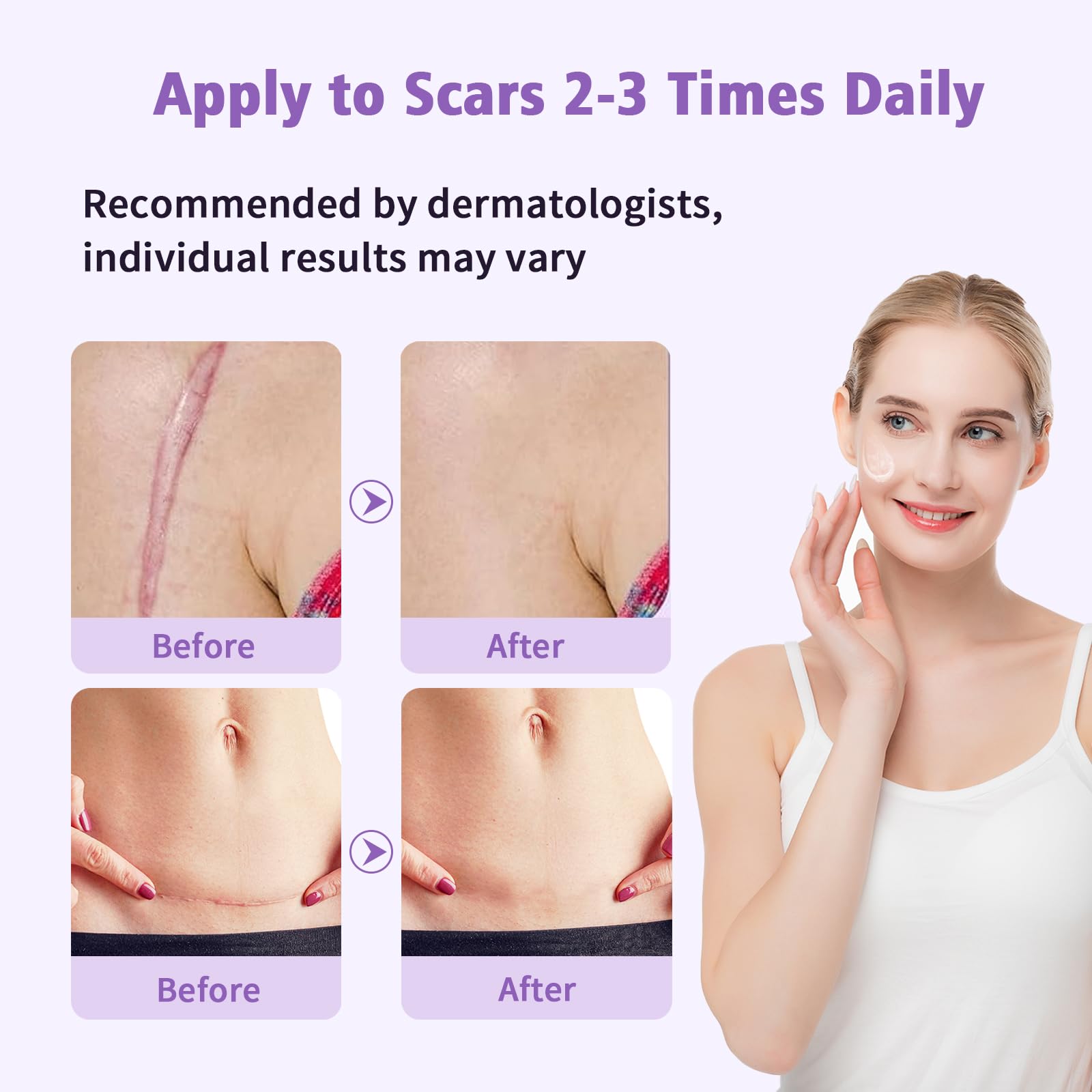 Yarster scar gel on elbow demonstrates conforming to joints