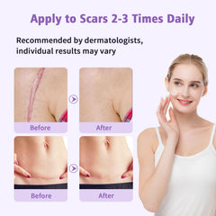 Yarster scar gel on elbow demonstrates conforming to joints