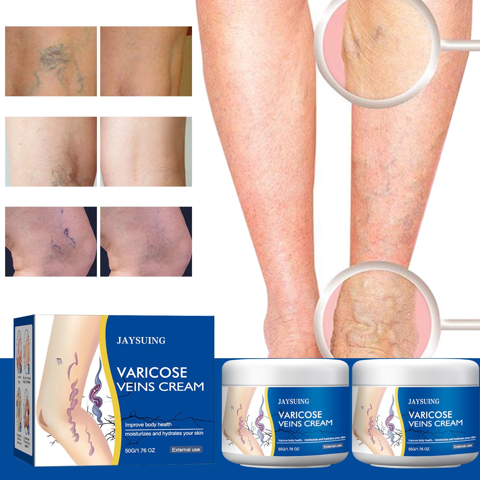 Yetary 2pcs pack varicose veins cream for legs showcased for everyday use.