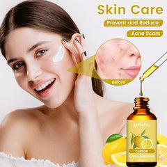 Lemon essential oil for skincare