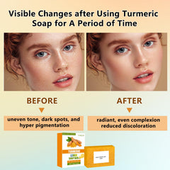 YIMEIR Vitamin C Brightening supports a more even-toned appearance.