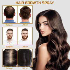 YoungGlove minoxidil biotin women use for hair growth