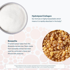 Joint health concept with bones and cartilage