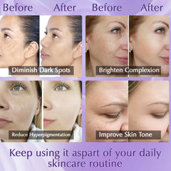 YRNVK vitamin C hyaluronic serum showing hydration and brightening potential