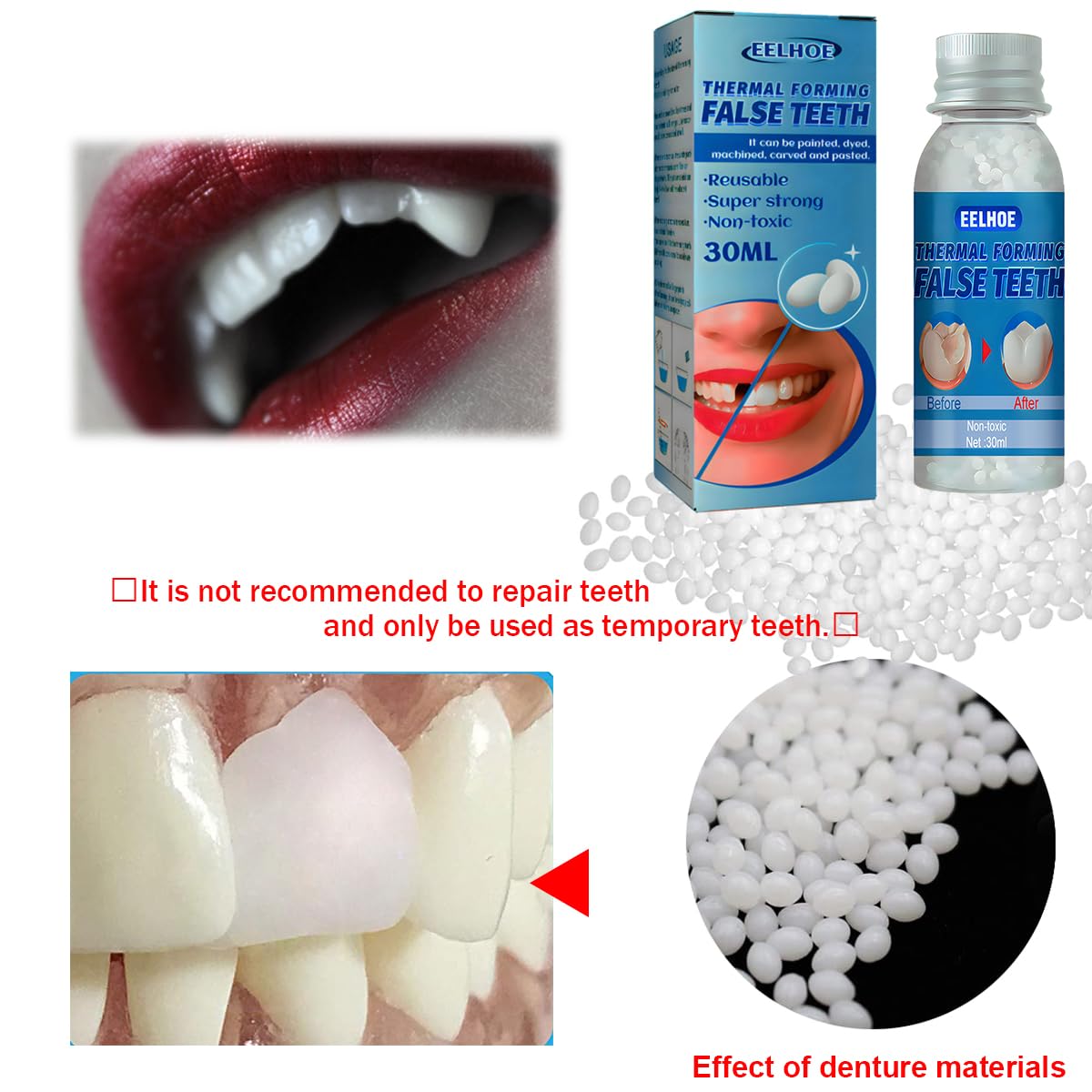 Thermoformed beads used in Yuehao dental restoration kit