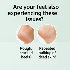 Yunmeng foot mask spray applied to clean feet for at-home pedicure steps