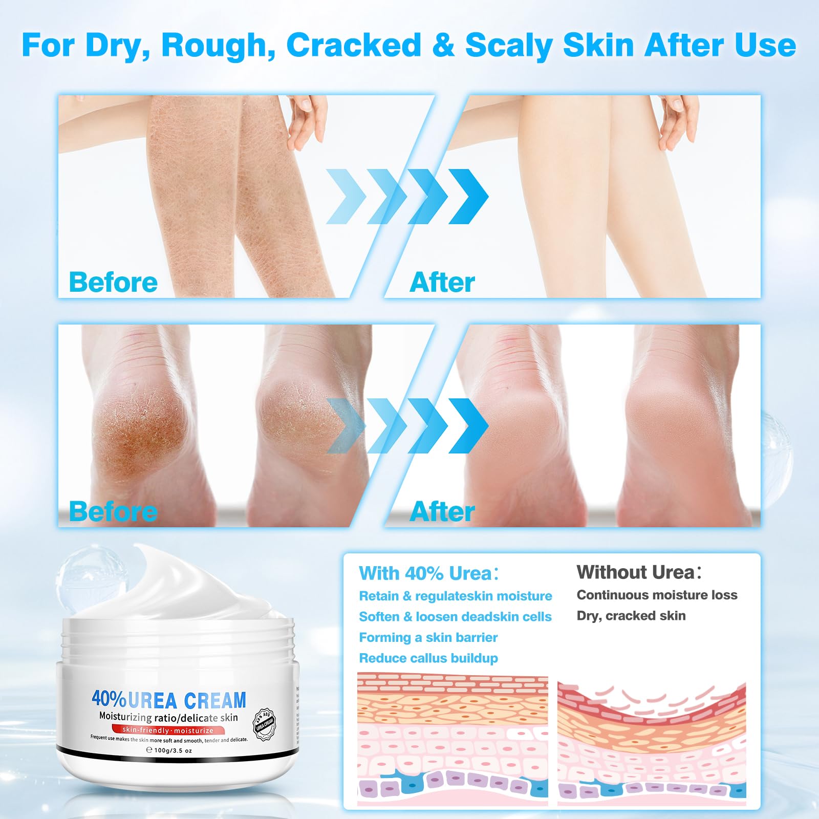 Yunmeng plastic sock set (50 pairs) to boost absorption.