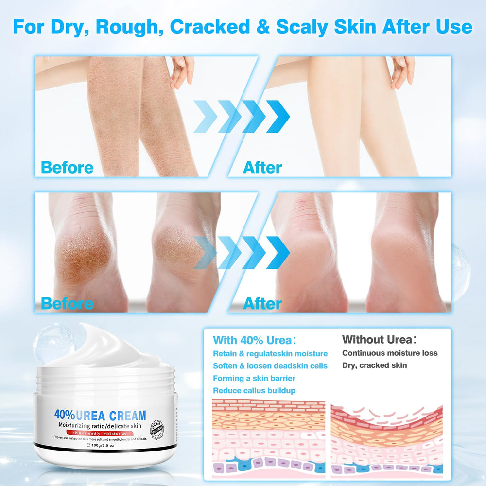 Yunmeng plastic sock set (50 pairs) to boost absorption.