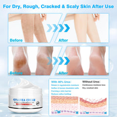 Yunmeng plastic sock set (50 pairs) to boost absorption.