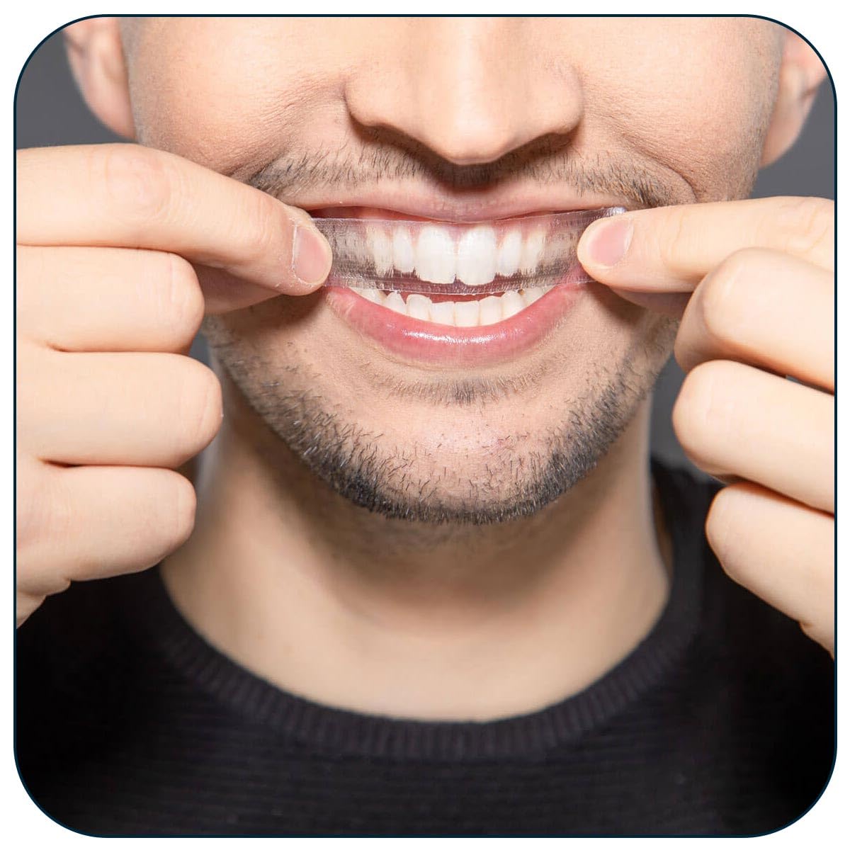 Before and after whitening results with ZAFINCO