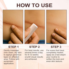 ZanDVRum Scar Solutions Stick gentle formula for sensitive skin.