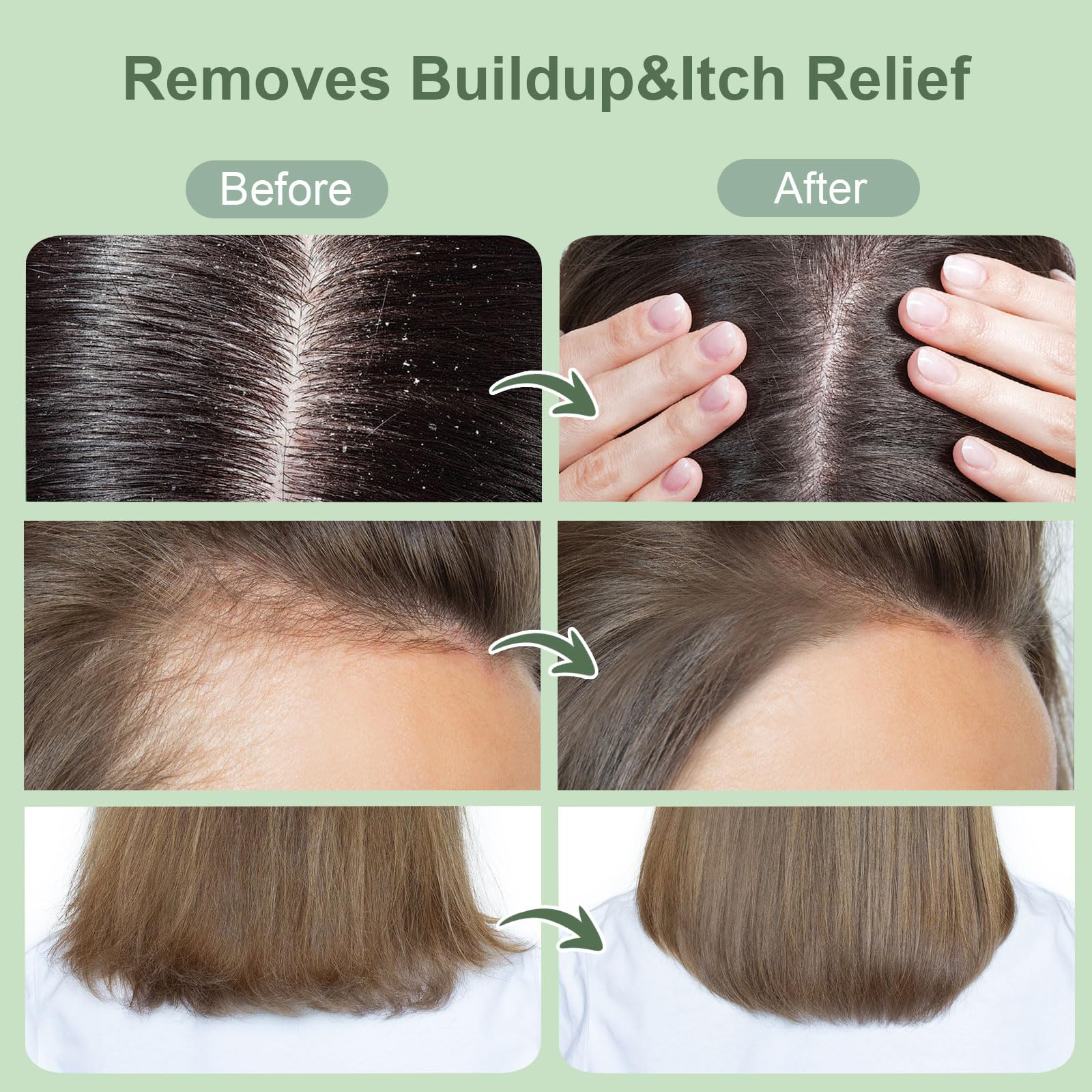 ZENGYQI exfoliating scrub application demonstrates a 2-3 minute scalp massage.
