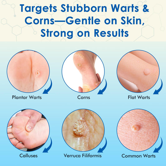 ZGjoib TAG Wart Remover bottle-cap close-up showing compact design