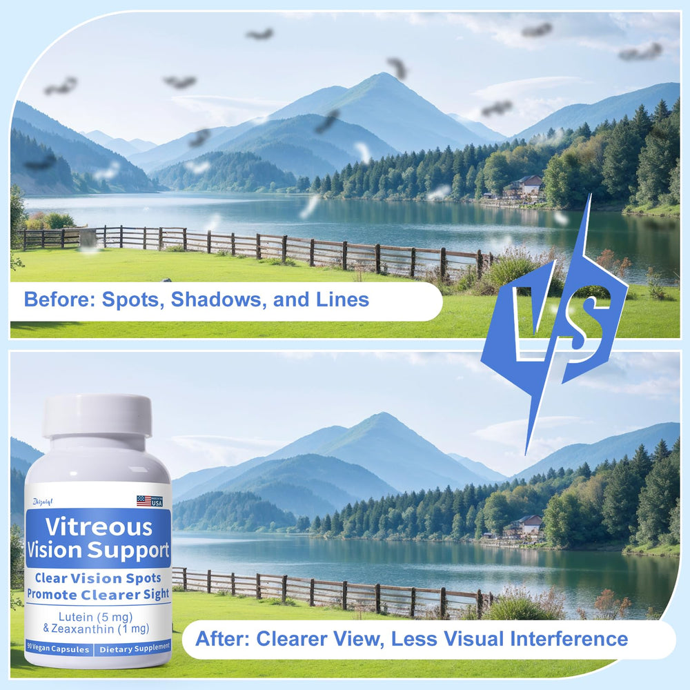 Vitamins C & E, Zinc, and Copper for eye health