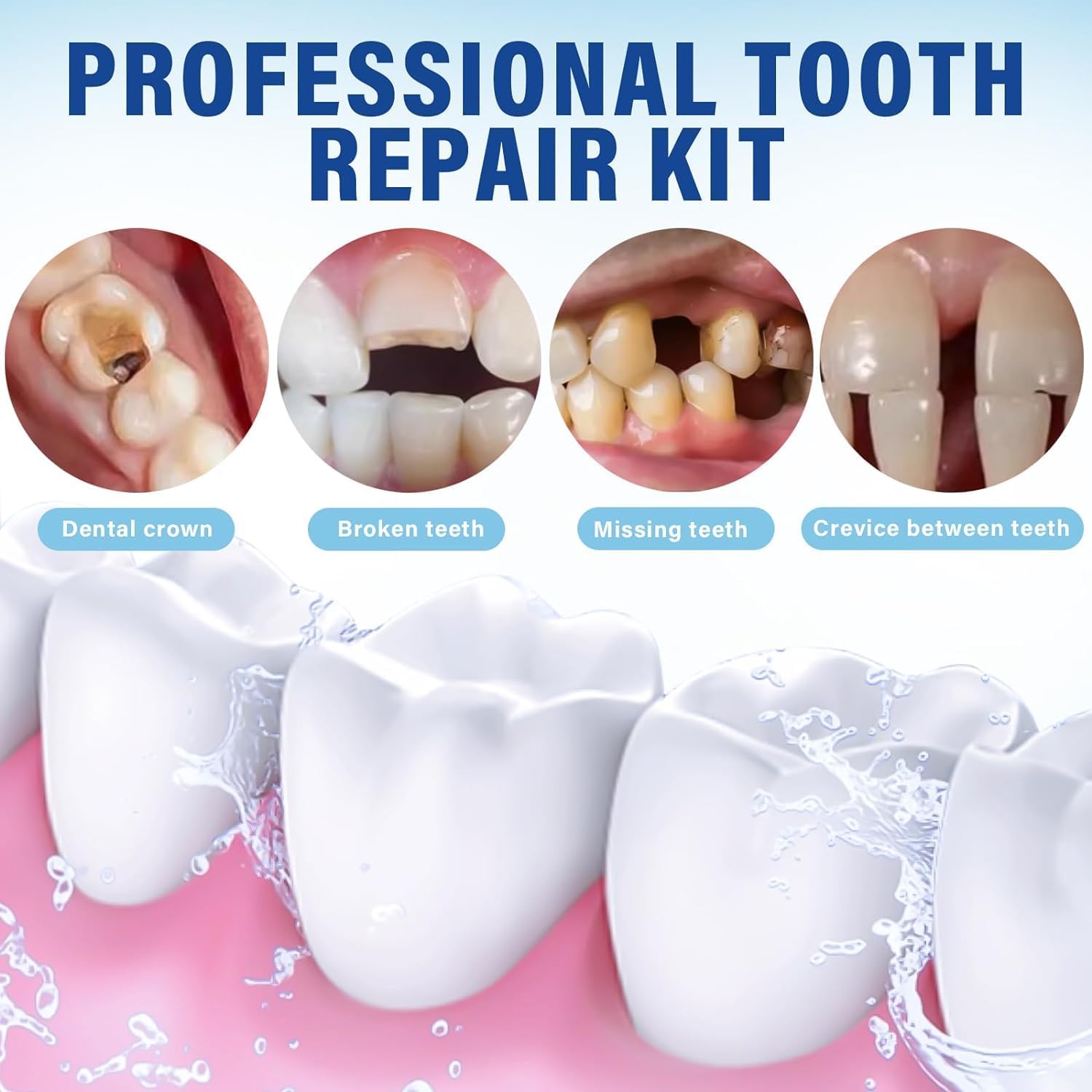Temporary replacement teeth set components