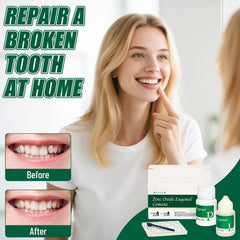 Temporary crowns and bridge repair set displayed