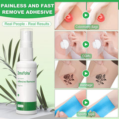 ZnnaYoha adhesive remover sensitive-skin application on skin.