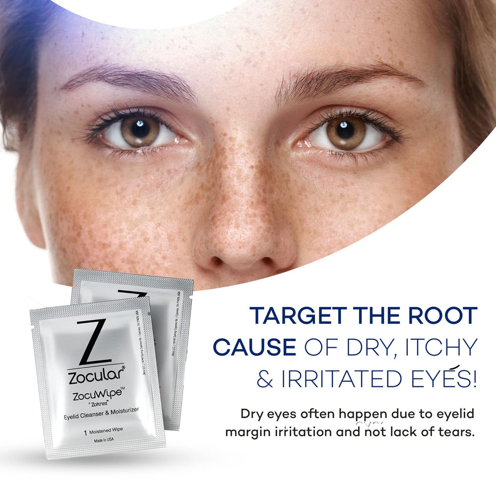 Zocular Zocuwipe demodex removal focus suggests clearer glands and reduced irritation.