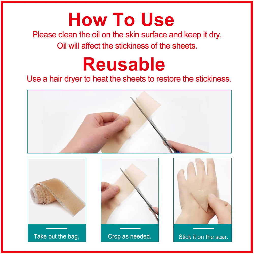 ZODENIS silicone scar sheets on acne scar showcasing discreet wear