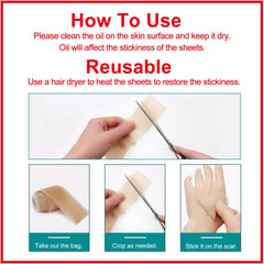 ZODENIS silicone scar sheets on acne scar showcasing discreet wear