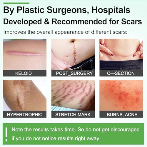 ZODENIS silicone scar sheets securing a medical device without pulling skin