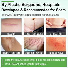 ZODENIS silicone scar sheets securing a medical device without pulling skin