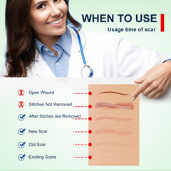 ZODENIS silicone scar sheets being unrolled for easy application and comfortable wear