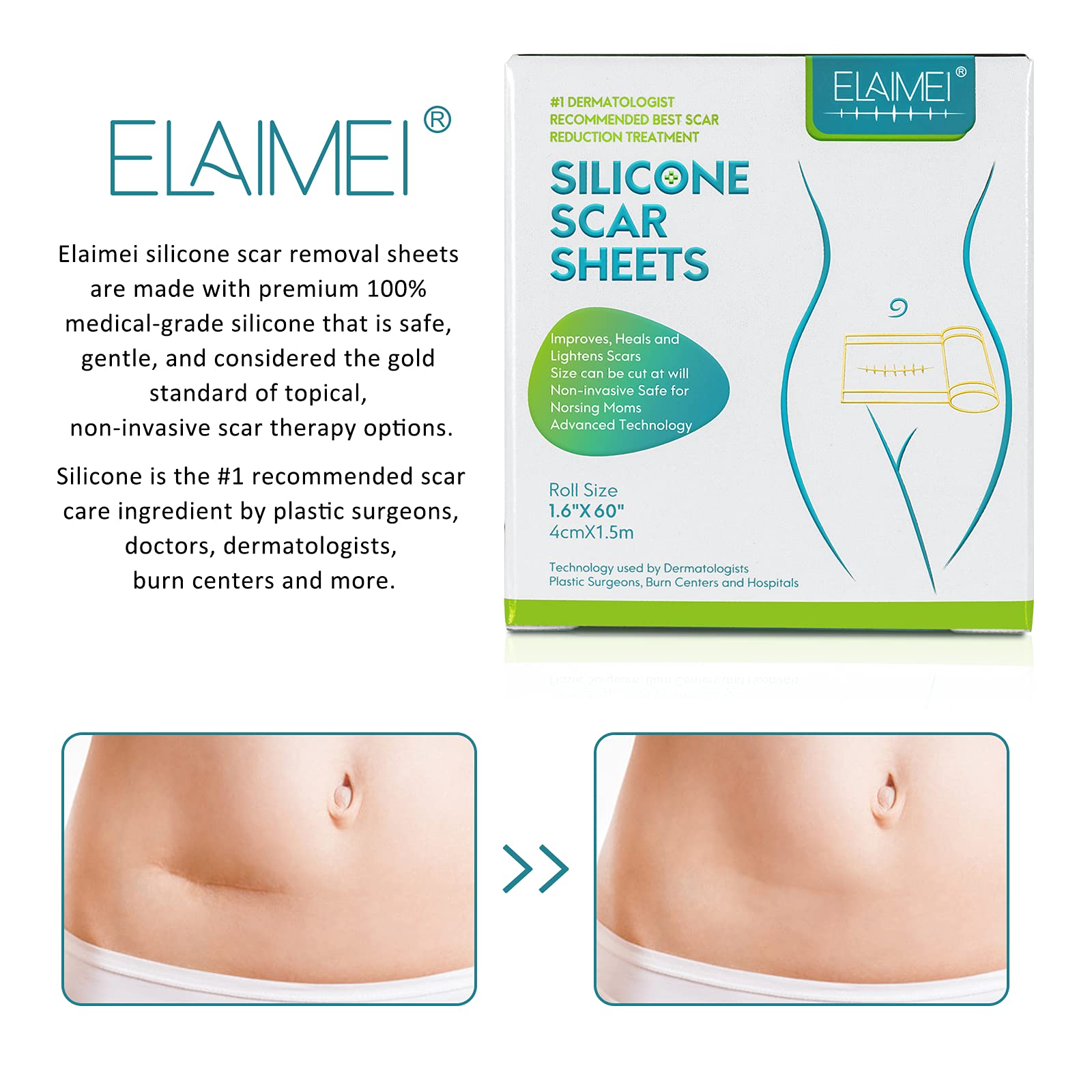 ZODENIS silicone scar tape packaging highlights medical-grade materials for safe scar care.