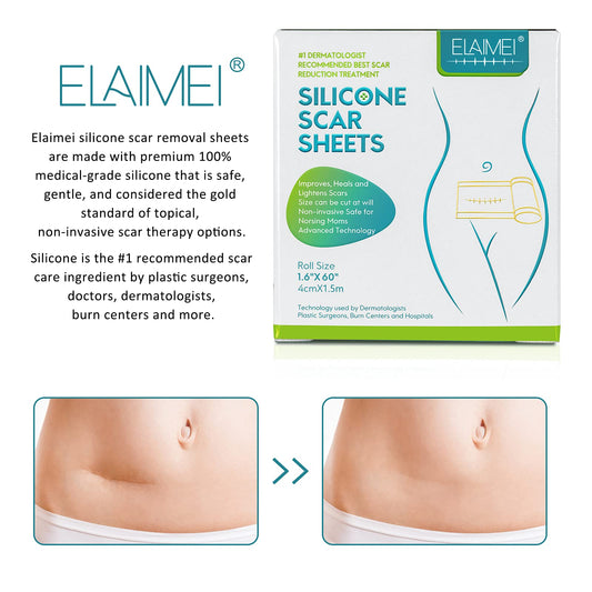 ZODENIS silicone scar tape packaging highlights medical-grade materials for safe scar care.