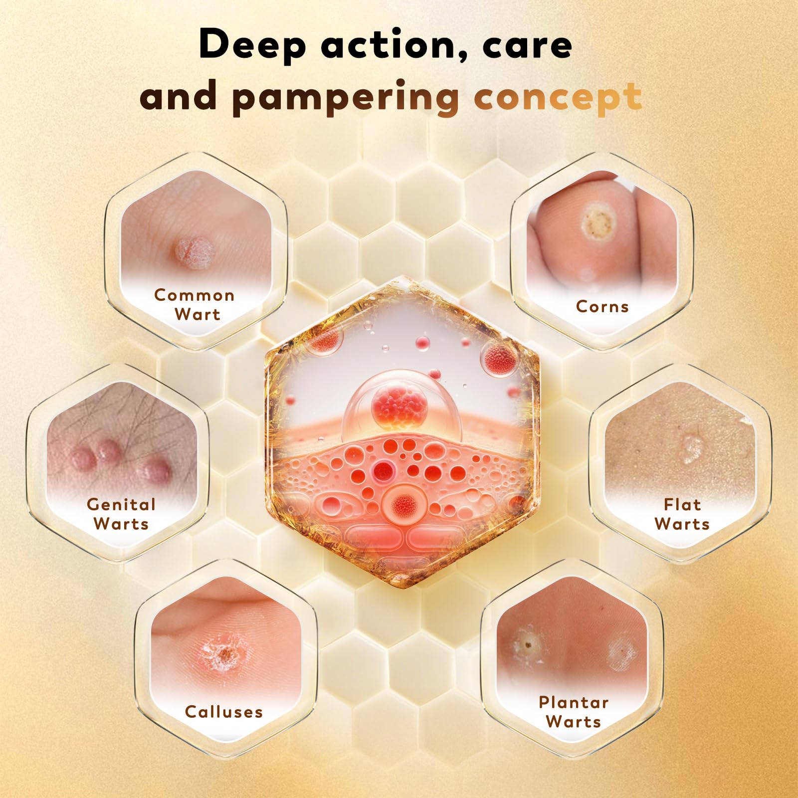 Zozdal bee venom wart remover applicator for quick at-home sessions
